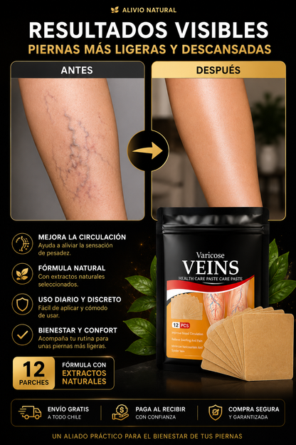 VenoCalm | Alivio para piernas cansadas